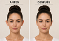 Auris — Corrector de orejas invisible